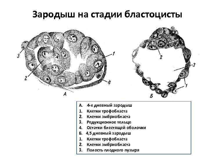 Зародыш на стадии бластоцисты А. 1. 2. 3. 4. Б. 1. 2. 3. 4