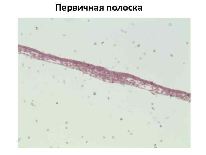 Первичная полоска 