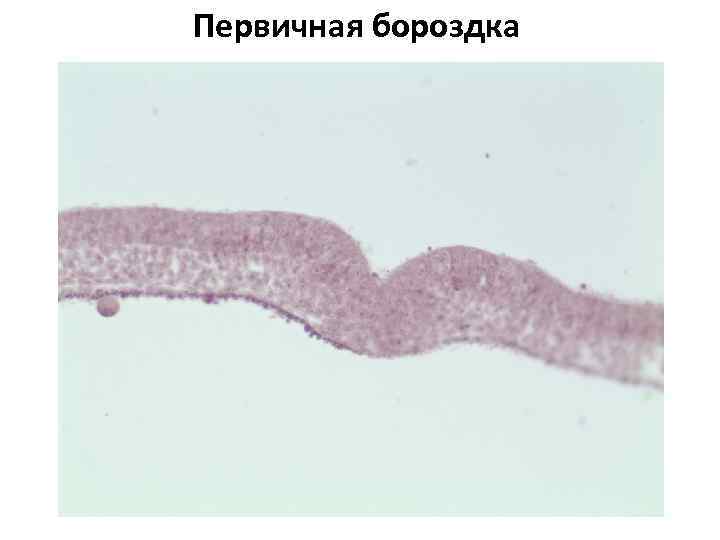 Первичная бороздка 