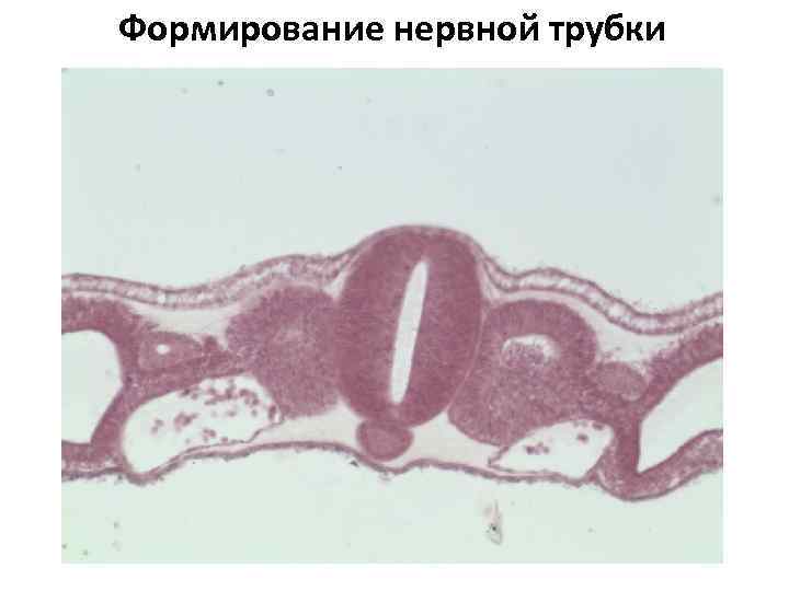 Формирование нервной трубки 