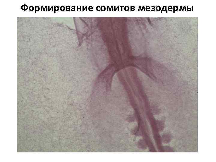 Формирование сомитов мезодермы 