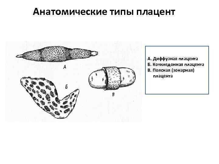 Анатомические типы плацент А. Диффузная плацента Б. Котиледонная плацента В. Поясная (зонарная) плацента 