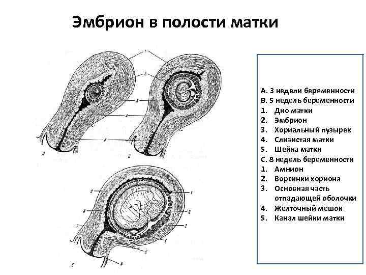 Эмбрион в полости матки А. 3 недели беременности В. 5 недель беременности 1. Дно