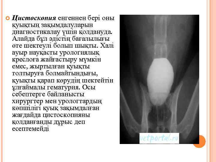  Цистоскопия енгеннен бері оны қуықтың зақымдалуларын диагностикалау үшін қолдануда. Алайда бұл әдістің бағалылығы