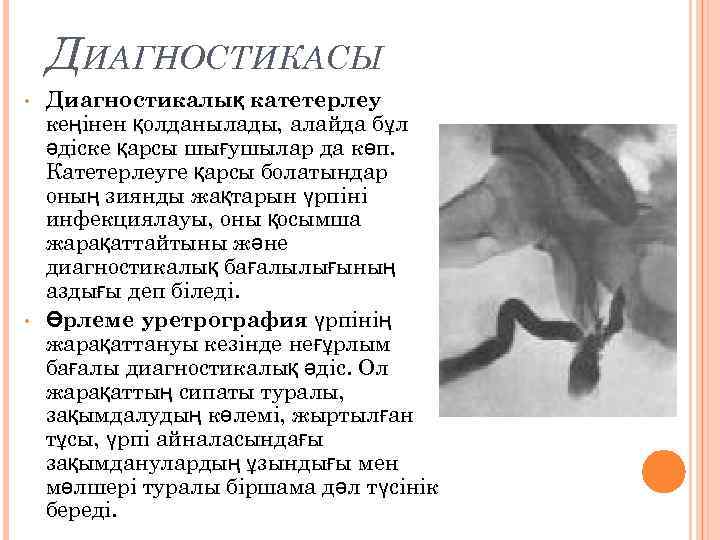 ДИАГНОСТИКАСЫ • • Диагностикалық катетерлеу кеңінен қолданылады, алайда бұл әдіске қарсы шығушылар да көп.
