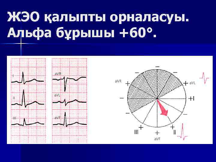 ЖЭО қалыпты орналасуы. Альфа бұрышы +60°. 