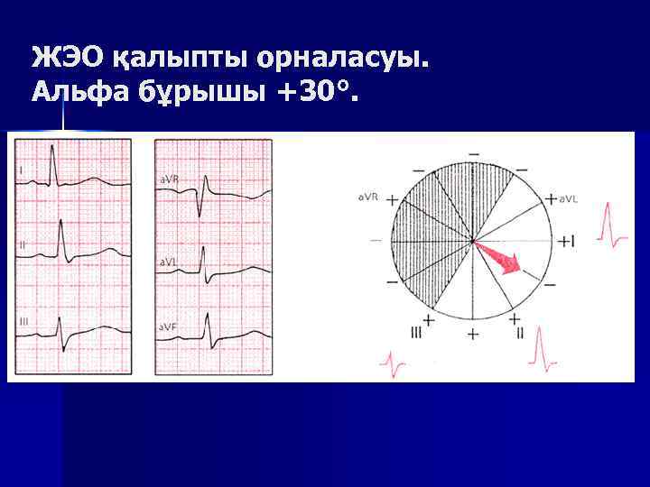 ЖЭО қалыпты орналасуы. Альфа бұрышы +30°. 