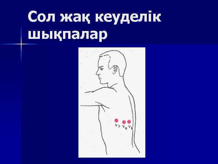 Сол жақ кеуделік шықпалар 