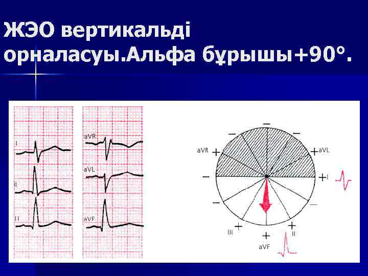 ЖЭО вертикальді орналасуы. Альфа бұрышы+90°. 