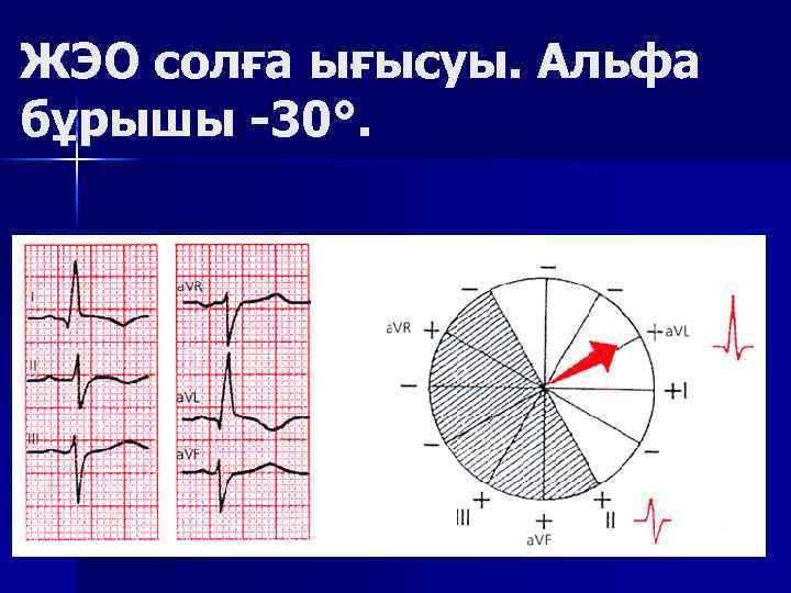 ЖЭО солға ығысуы. Альфа бұрышы -30°. 