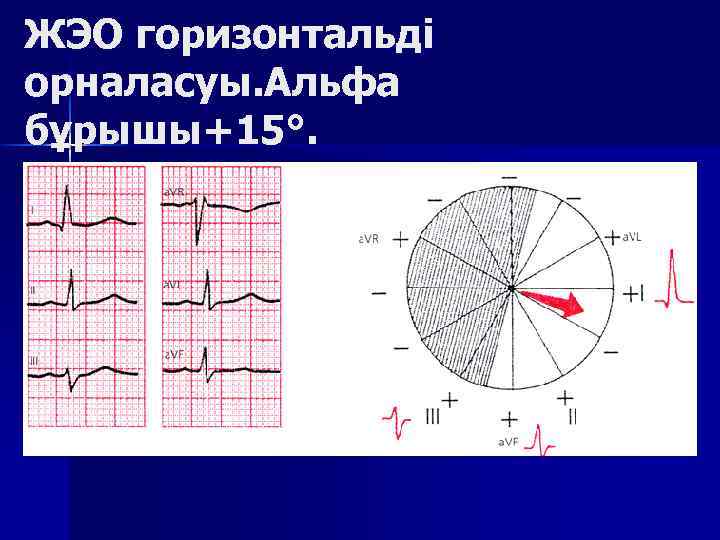 ЖЭО горизонтальді орналасуы. Альфа бұрышы+15°. 