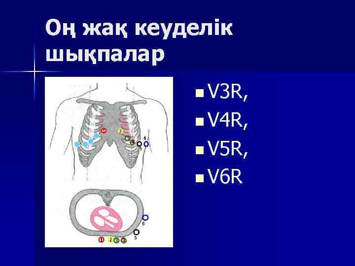 Оң жақ кеуделік шықпалар n V 3 R, n V 4 R, n V