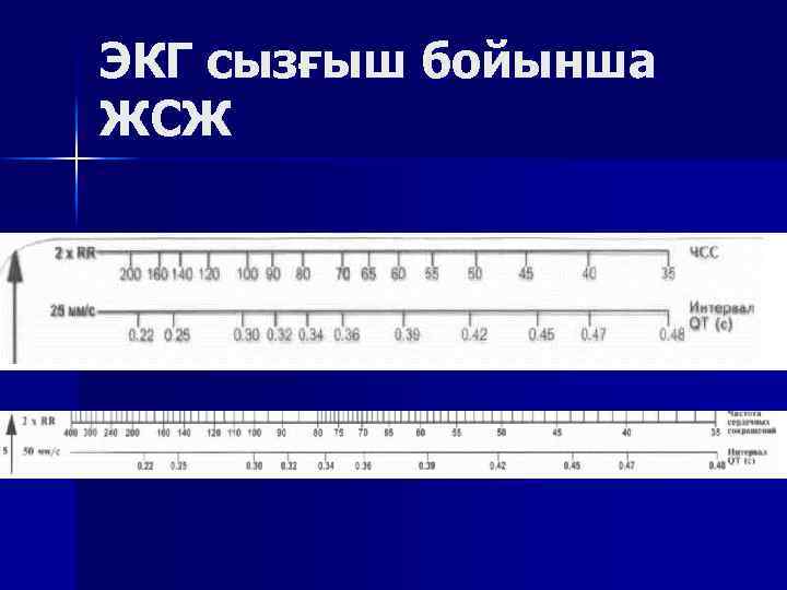 ЭКГ сызғыш бойынша ЖСЖ 