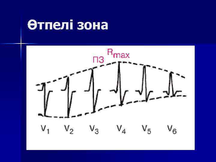 Өтпелі зона 