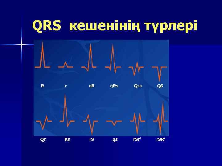 QRS кешенінің түрлері R r q. Rs Qrs QS Qr Rs r. S qs