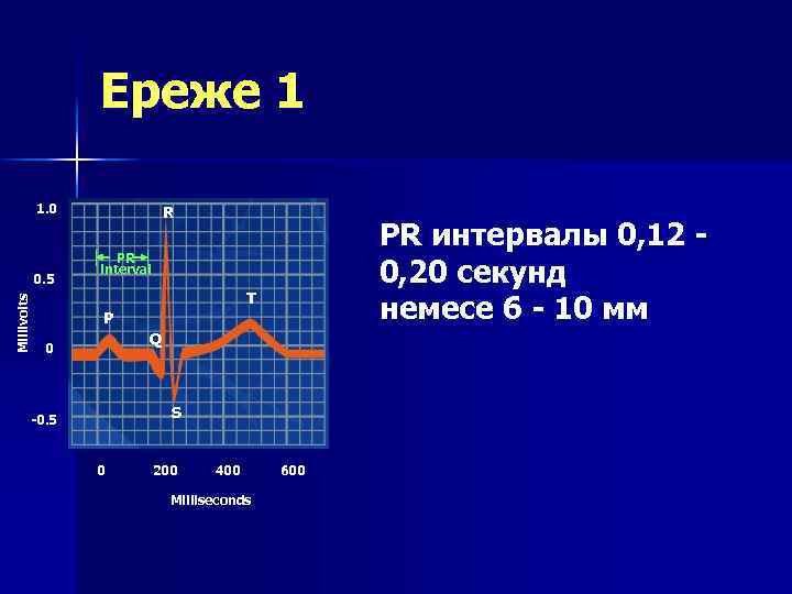 Ереже 1 1. 0 Millivolts 0. 5 R PR интервалы 0, 12 0, 20