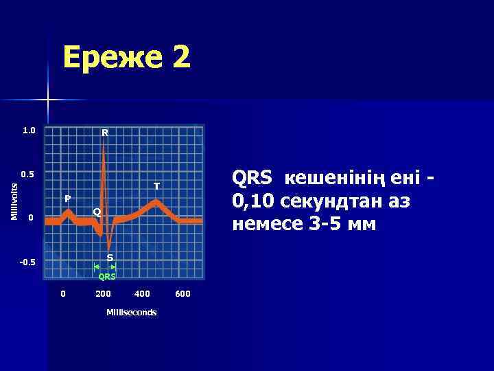 Ереже 2 1. 0 R QRS кешенінің ені 0, 10 секундтан аз немесе 3