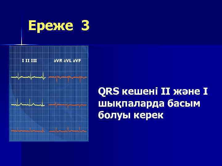 Ереже 3 I II III a. VR a. VL a. VF QRS кешені II