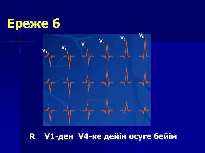 Ереже 6 V 1 R V 2 V 3 V 4 V 5 V