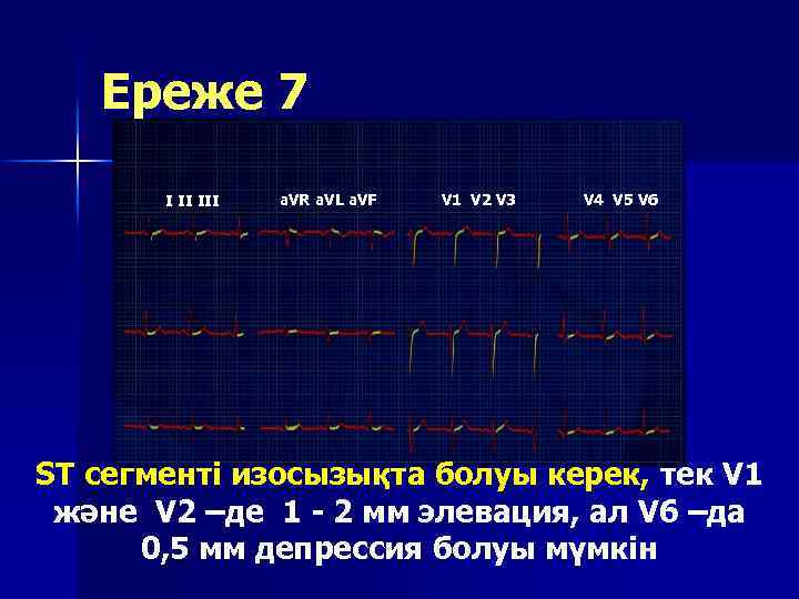 Ереже 7 I II III a. VR a. VL a. VF V 1 V