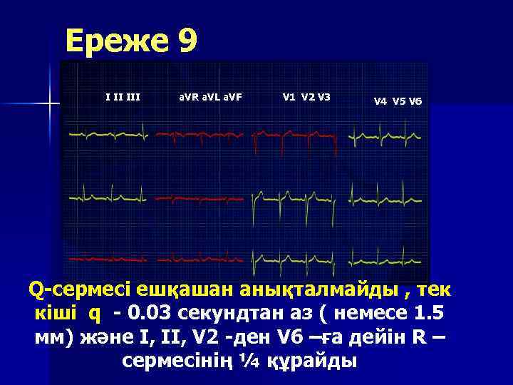Ереже 9 I II III a. VR a. VL a. VF V 1 V