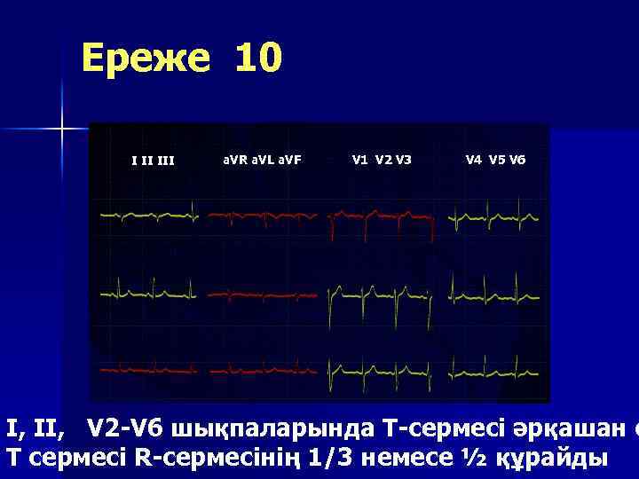 Ереже 10 I II III a. VR a. VL a. VF V 1 V