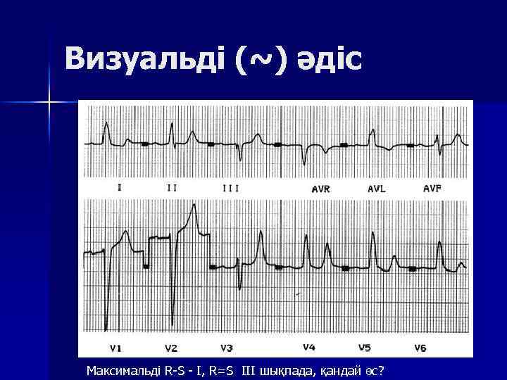 Визуальді (~) әдіс Максимальді R S I, R=S III шықпада, қандай өс? 