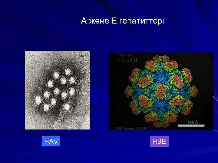 А және Е гепатиттері HAV HBЕ 