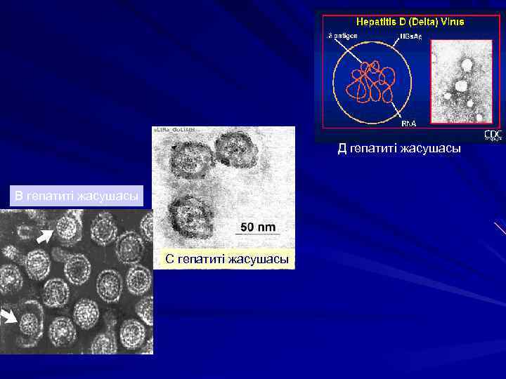 Д гепатиті жасушасы В гепатиті жасушасы С гепатиті жасушасы 