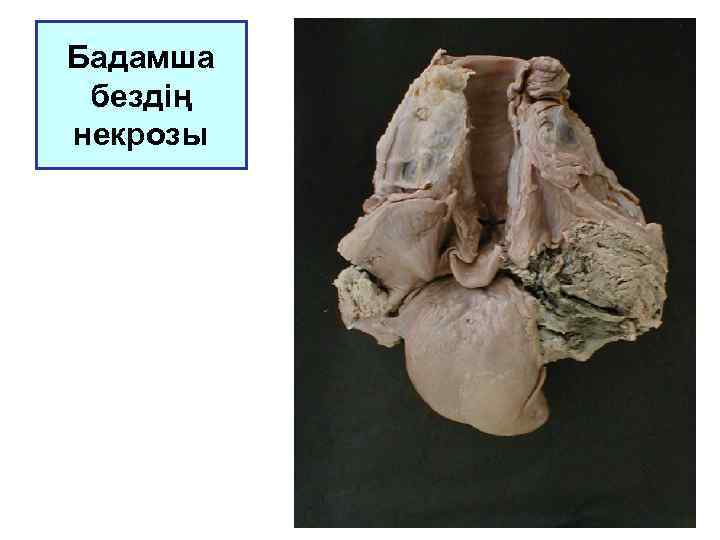 Бадамша бездің некрозы 