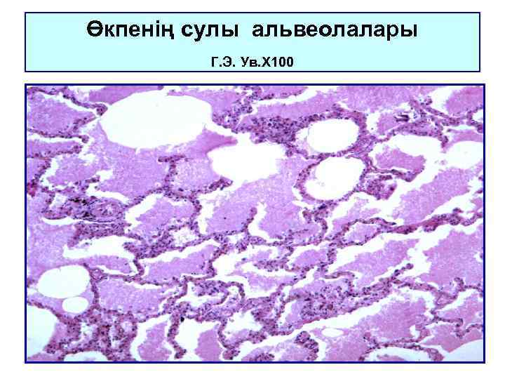 Өкпенің сулы альвеолалары Г. Э. Ув. Х 100 