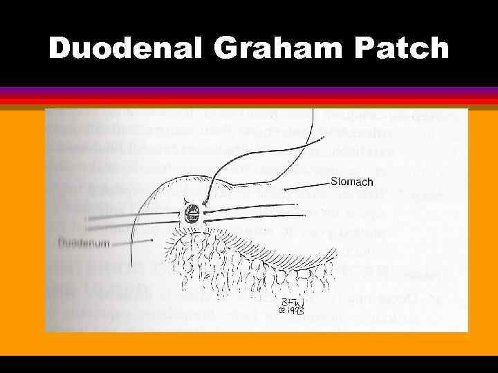 Duodenal Graham Patch 