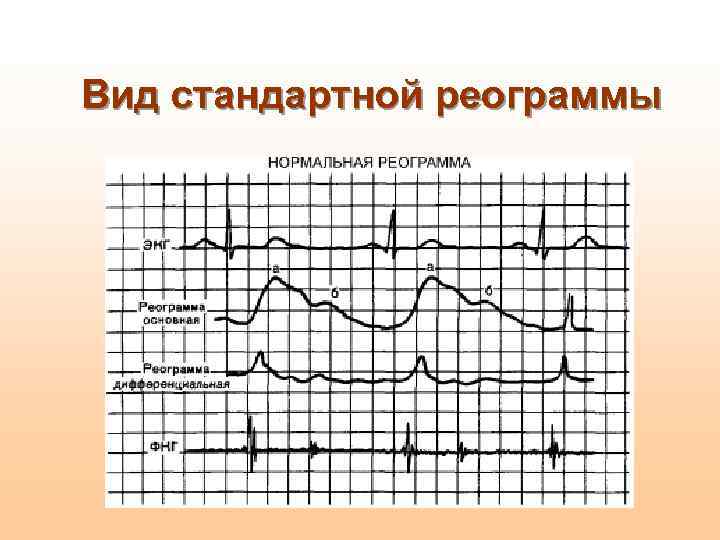 Вид стандартной реограммы 