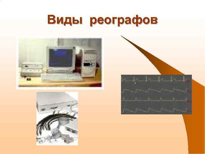 Виды реографов 
