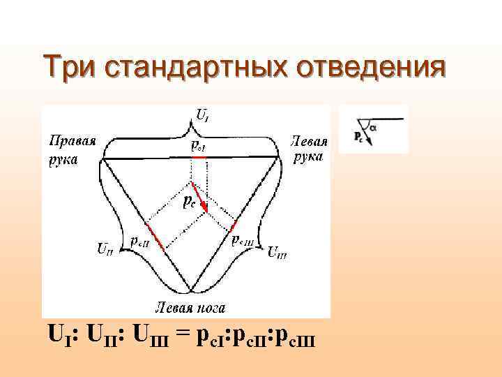 Три стандартных отведения UI: UIII = рс. I: рс. III 