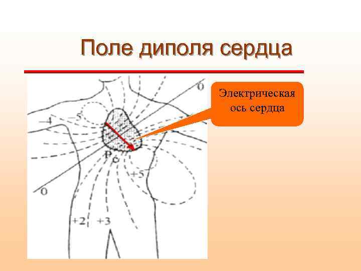 Поле диполя сердца Электрическая ось сердца 