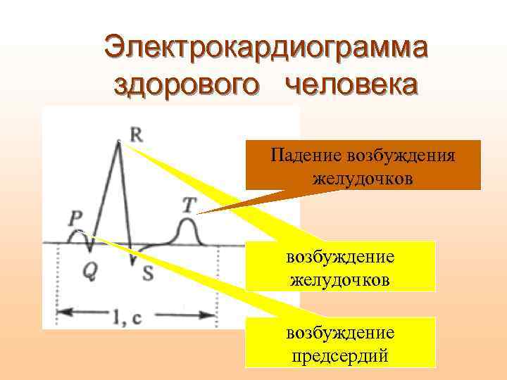 Электрокардиограмма здорового человека Падение возбуждения желудочков возбуждение предсердий 