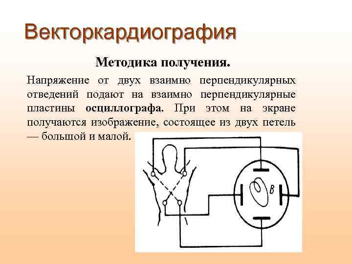 Векторкардиография Методика получения. Напряжение от двух взаимно перпендикулярных отведений подают на взаимно перпендикулярные пластины