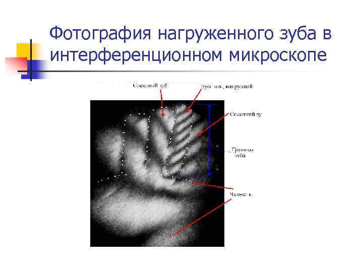 Фотография нагруженного зуба в интерференционном микроскопе 