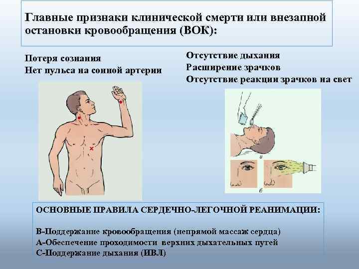 Главные признаки клинической смерти или внезапной остановки кровообращения (ВОК): Потеря сознания Нет пульса на