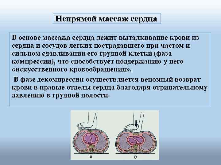 Непрямой массаж сердца В основе массажа сердца лежит выталкивание крови из сердца и сосудов