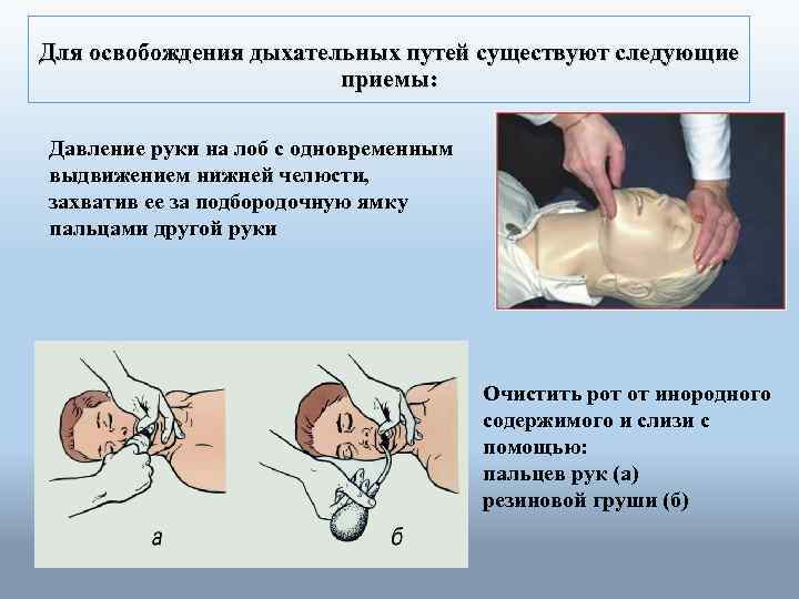 Для освобождения дыхательных путей существуют следующие приемы: Давление руки на лоб с одновременным выдвижением