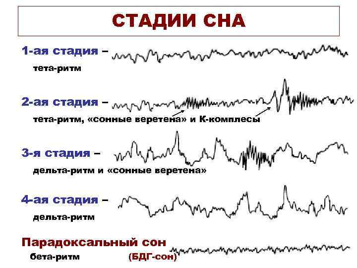 Слепые по фазе сна