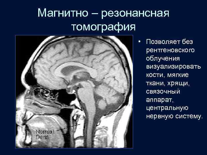 Магнитно – резонансная томография • Позволяет без рентгеновского облучения визуализировать кости, мягкие ткани, хрящи,