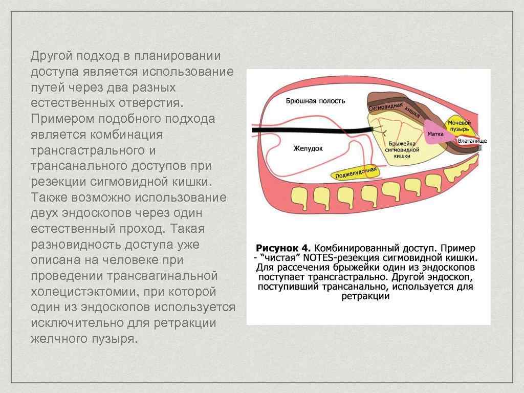 Транслюминальная хирургия презентация