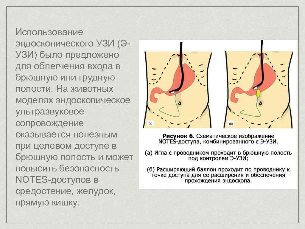 Узи хирургия презентация