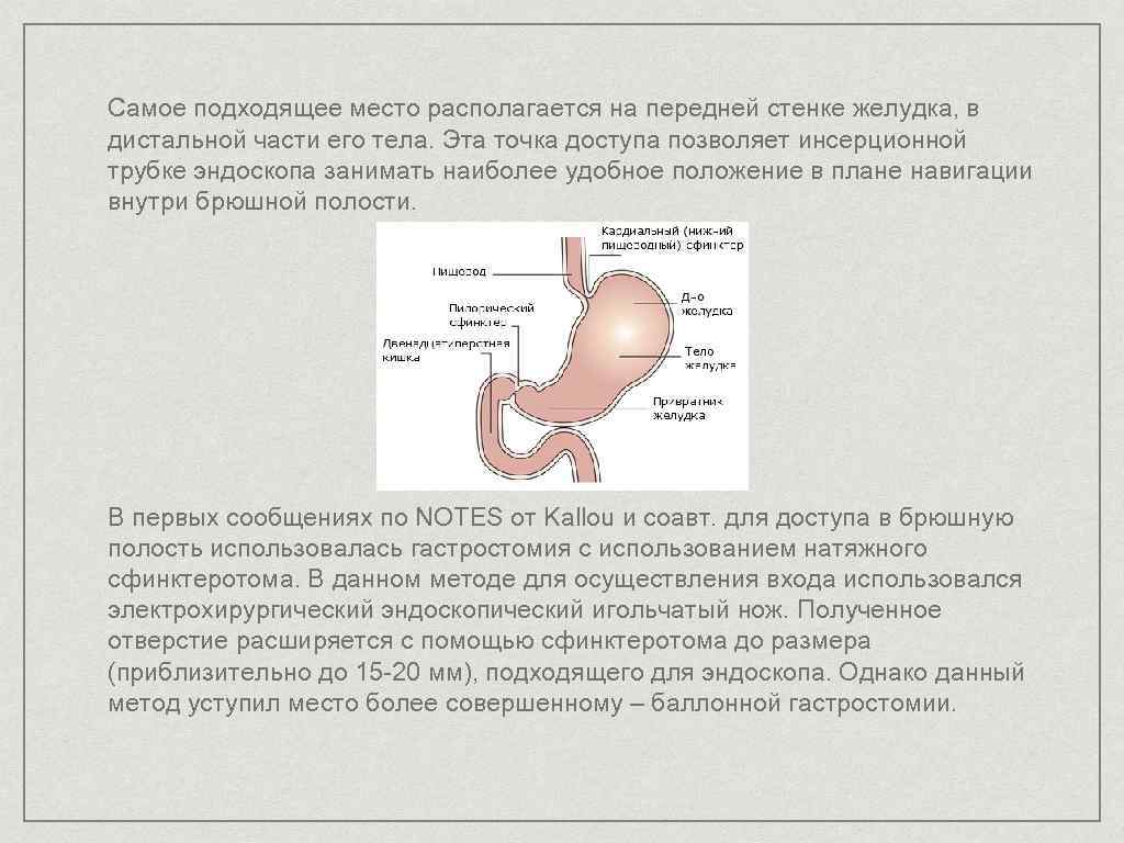 Самое подходящее место располагается на передней стенке желудка, в дистальной части его тела. Эта