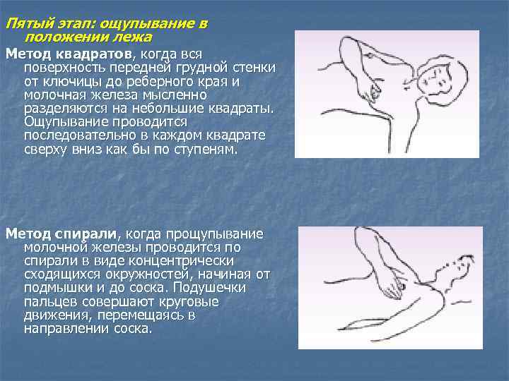 Пятый этап: ощупывание в положении лежа Метод квадратов, когда вся поверхность передней грудной стенки