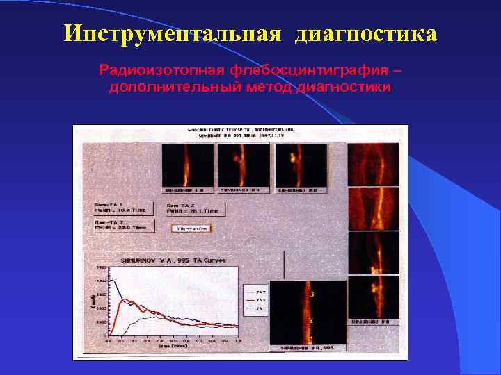 Тромбофлебит нижних конечностей локальный статус карта вызова