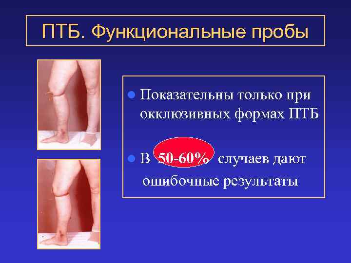ПТБ. Функциональные пробы l Показательны только при окклюзивных формах ПТБ l. В 50 -60%